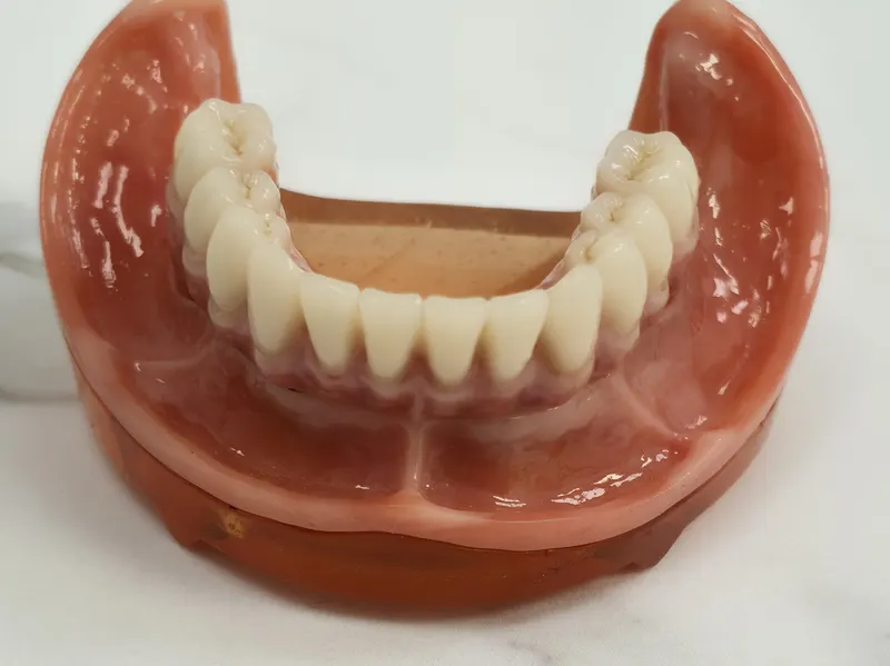 Arcadă inferioară completă, cu dinți ceramici și gingie roz, pe modelul de lucru