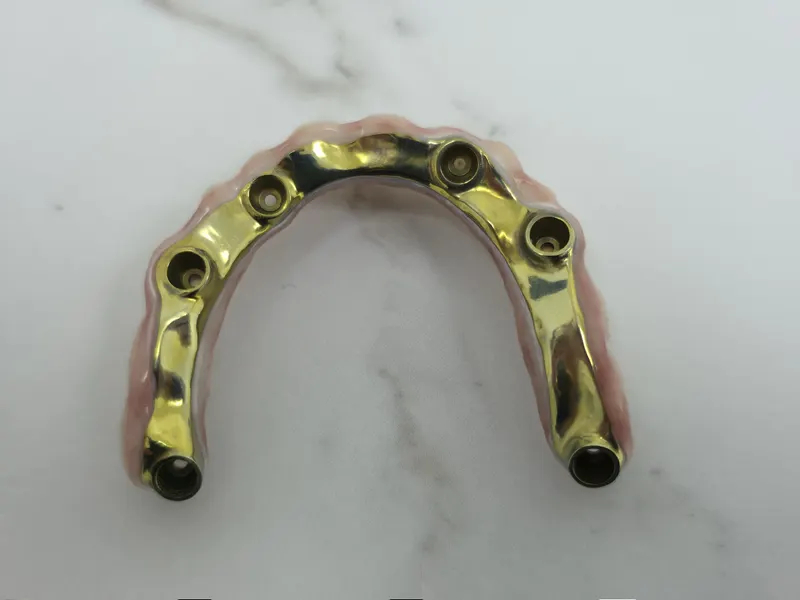 Bară metalică aurie în formă de arc, cu orificii pentru implanturi, pe marmură albă