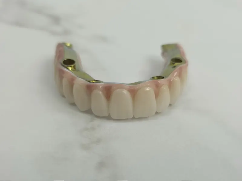 Arcadă cu dinți ceramici montată pe bara metalică, văzută din față, pe marmură albă