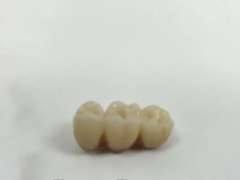 Punte dentară din trei elemente ceramice