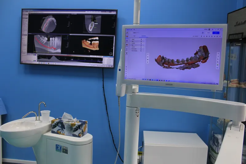 Ecran în cabinet cu imagini radiologice 3D ale mandibulei și, în prim-plan, un monitor cu scanarea 3D a unei arcade