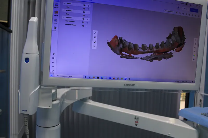 Monitor lângă unitul dentar, cu modelul 3D al unei arcade obținut prin scanare intraorală