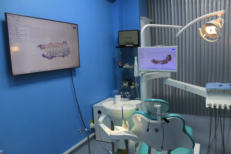 Ecrane cu scanarea 3D a unei arcade, deasupra unitului dentar turcoaz