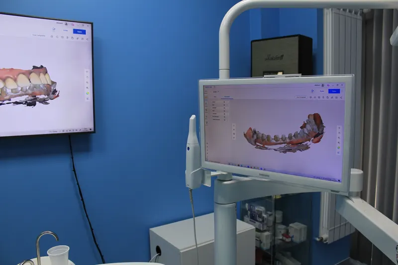 Monitoare cu scanarea 3D a unei arcade, lângă unitul dentar