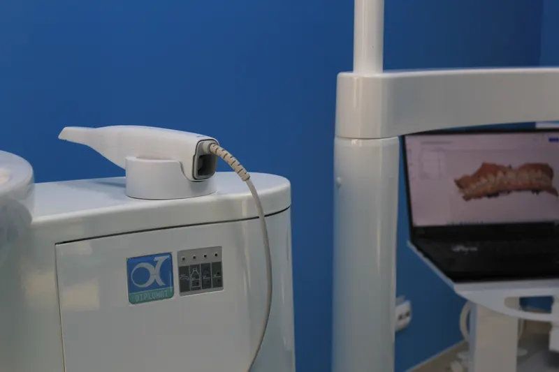 Scanner intraoral lângă laptopul cu scanarea 3D a unei arcade