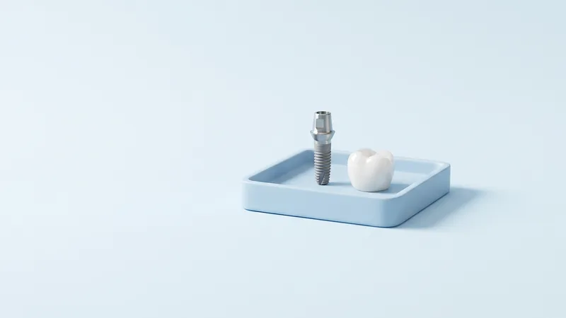 Implant dentar din titan cu bont protetic, lângă o coroană albă din ceramică, pe o tavă albastru pal