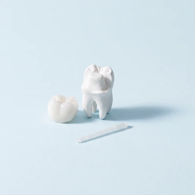 Coroană ceramică lângă un molar pregătit pentru ea și un pivot din fibră de sticlă