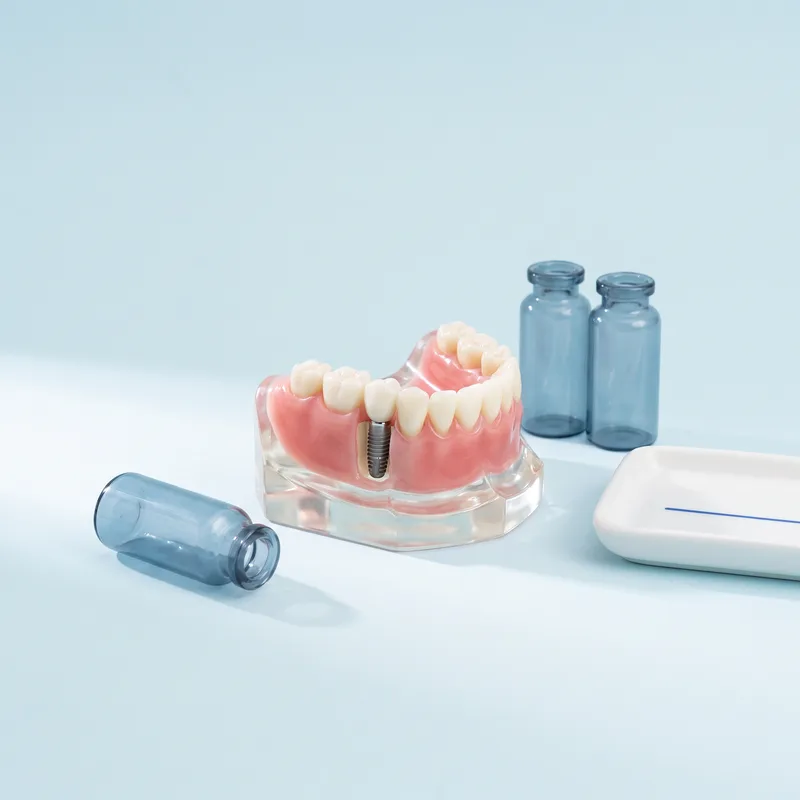 Model cu gingie sănătoasă în jurul unui implant cu coroană
