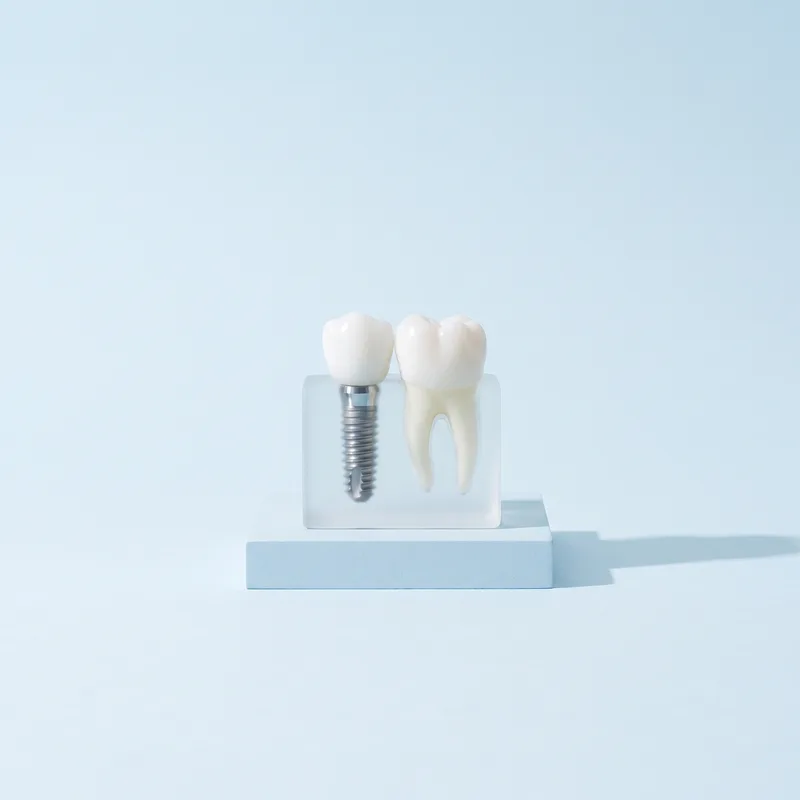 Model în secțiune cu un implant din titan în os și o coroană pe el