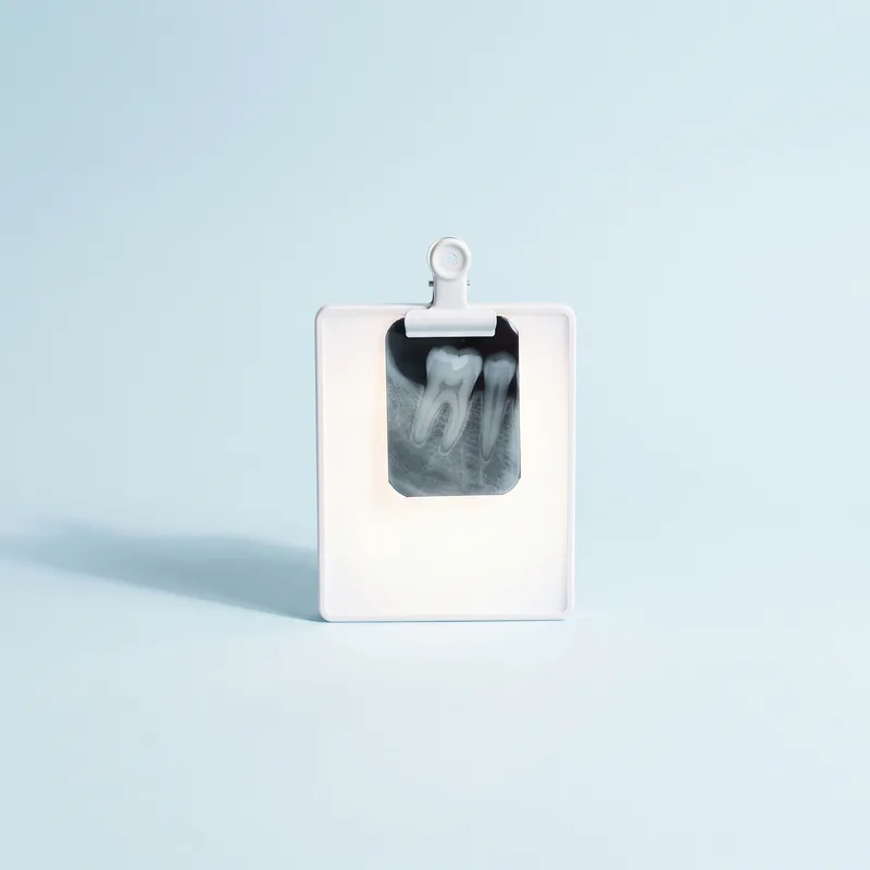 Radiografie dentară a unui molar, pe un panou luminos