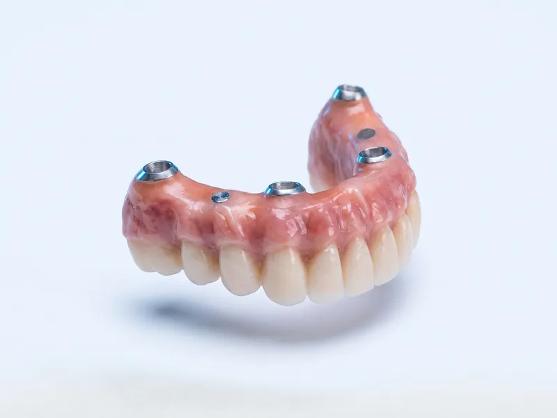 Arcadă dentară fixă cu dinți ceramici și gingie roz, pregătită pentru montarea pe implanturi