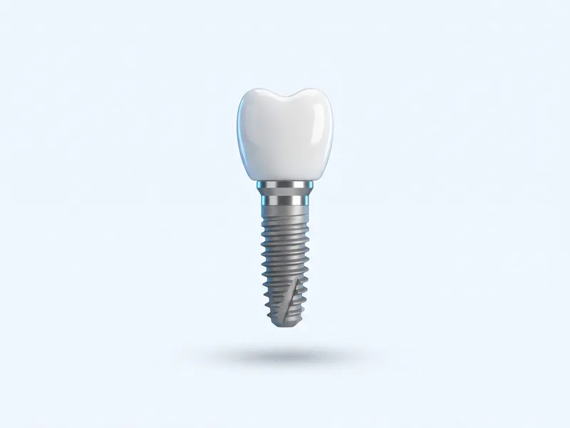 Implant dentar din titan cu coroană din zirconiu