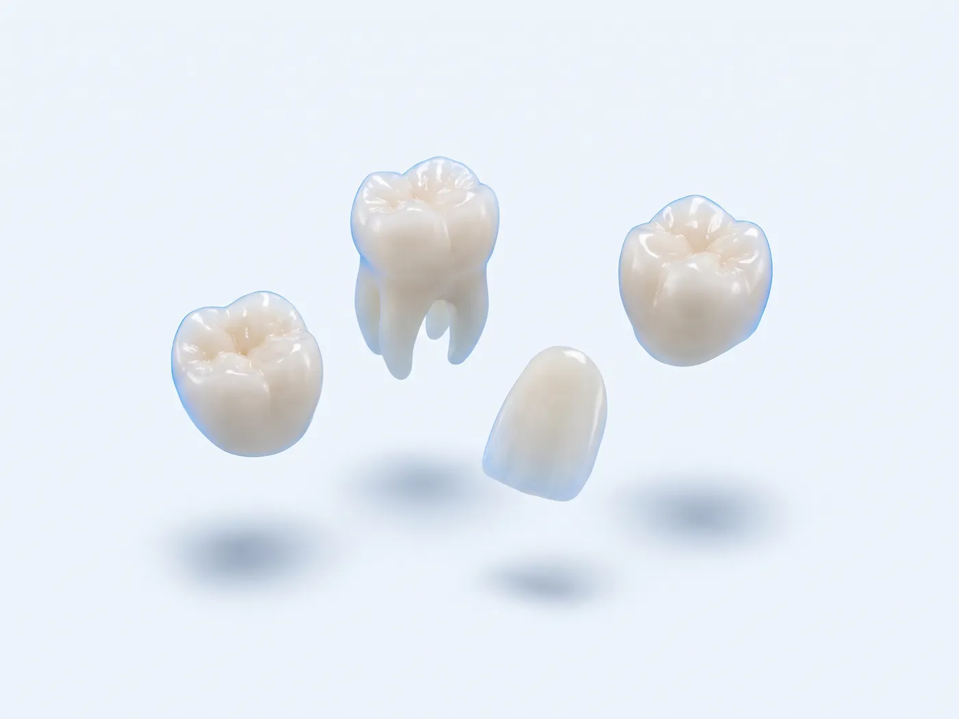 Coroane dentare din zirconiu și o fațetă ceramică
