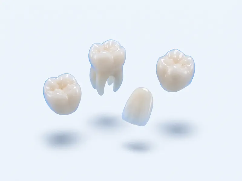Coroane dentare din zirconiu și o fațetă ceramică